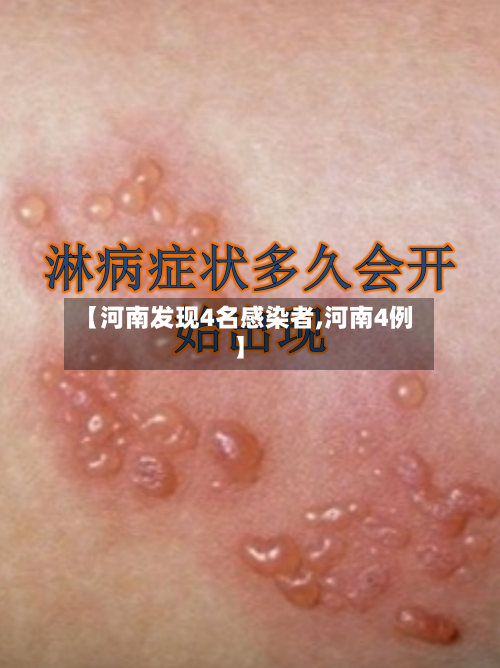 【河南发现4名感染者,河南4例】-第3张图片