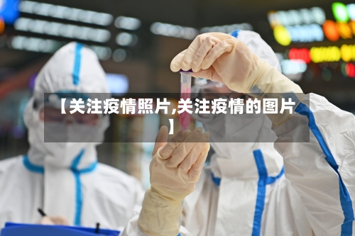 【关注疫情照片,关注疫情的图片】-第1张图片