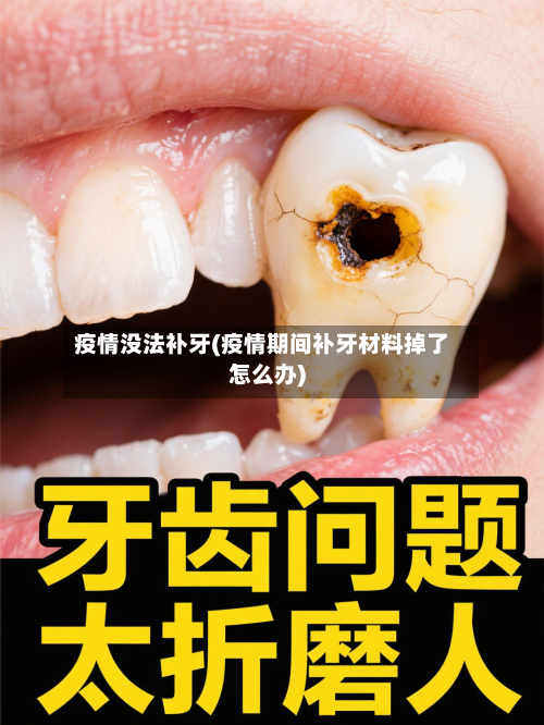 疫情没法补牙(疫情期间补牙材料掉了怎么办)-第3张图片